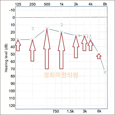 전후사진 이미지1