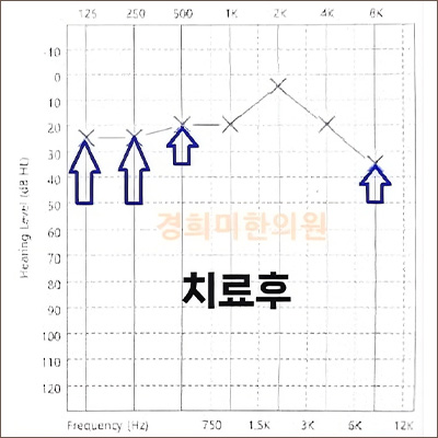 전후사진 이미지2