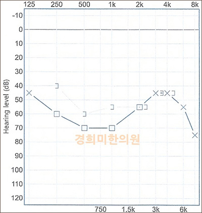 전후사진 이미지1