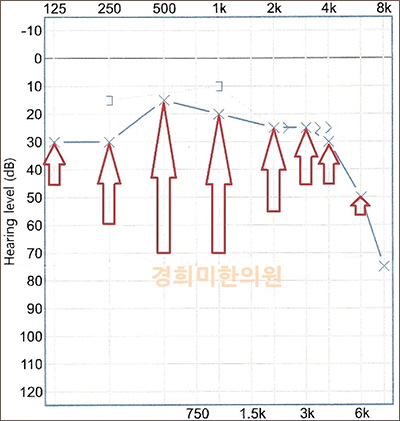 전후사진 이미지2