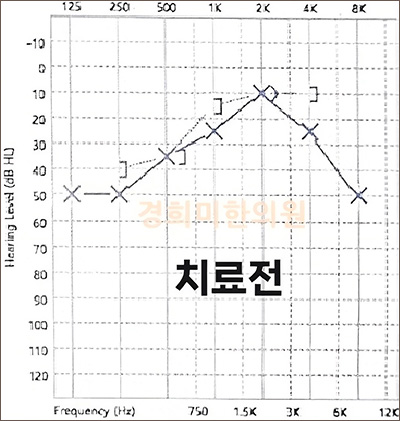 전후사진 이미지3