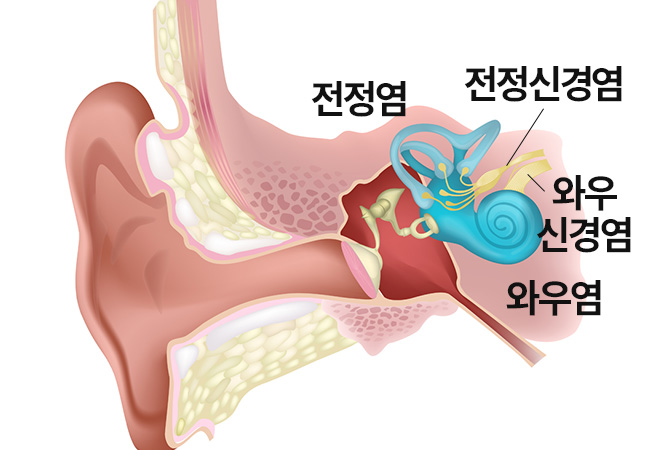 원인 이미지2