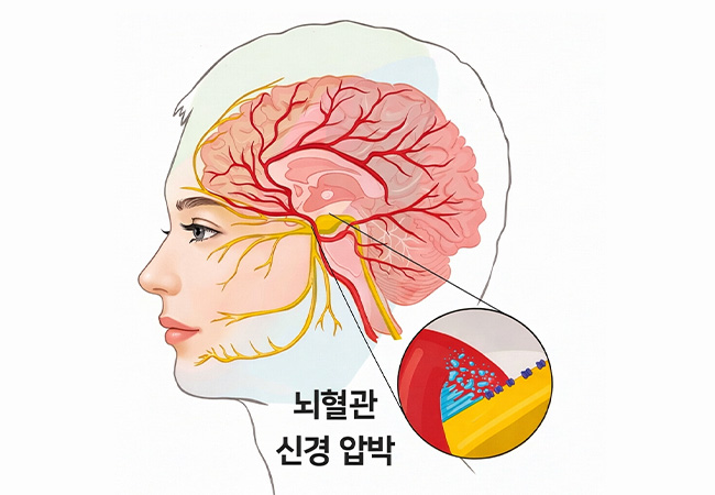원인 이미지2