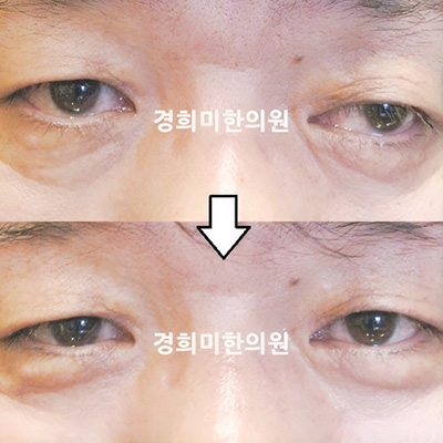 전후사진 이미지4