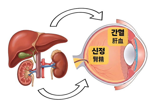 원인 이미지2