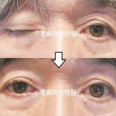 전후사진 이미지4