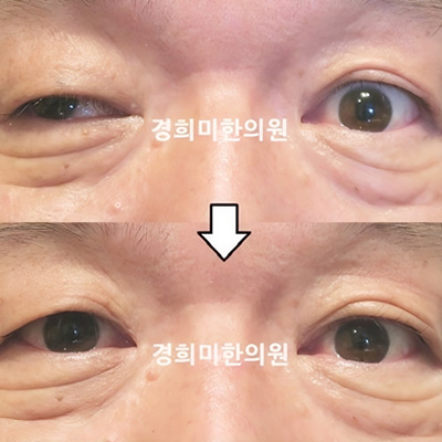전후사진 이미지6