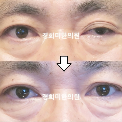 전후사진 이미지9