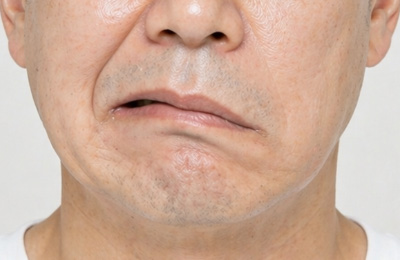 증상 이미지4