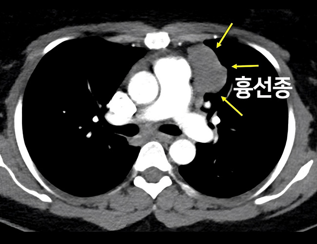 검사 이미지1