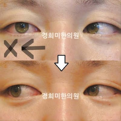 전후사진 이미지10