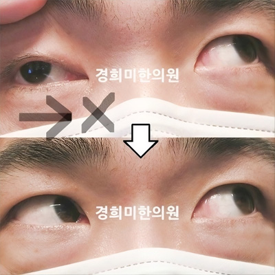 전후사진 이미지11