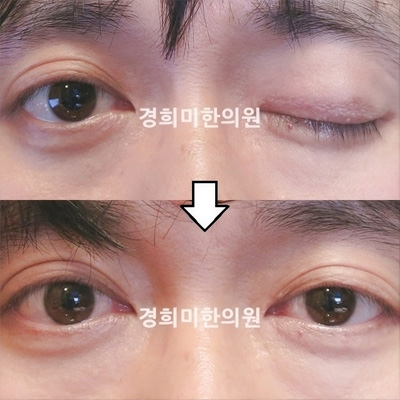전후사진 이미지4