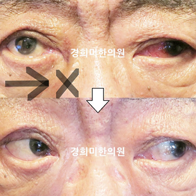 전후사진 이미지9
