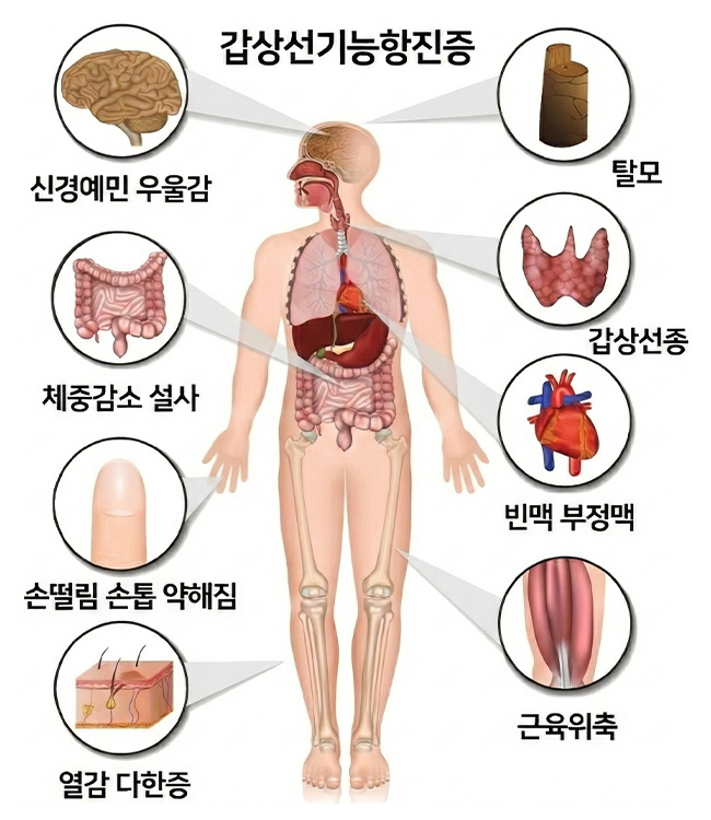 원인 이미지2
