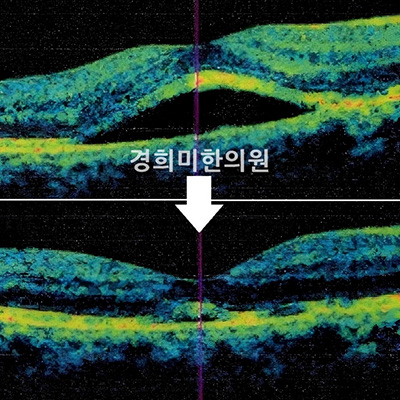 전후사진 이미지2