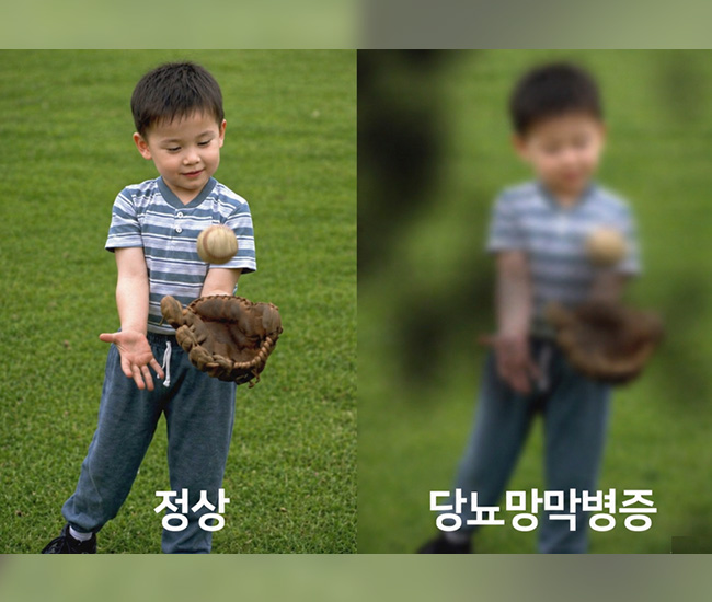 증상 이미지2