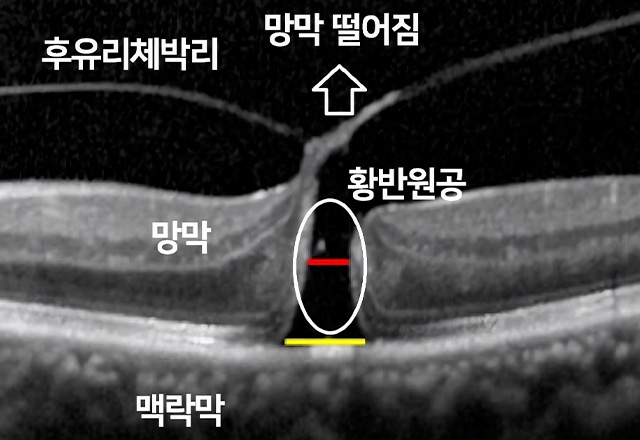 관계 이미지1