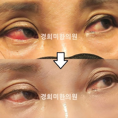 전후사진 이미지2
