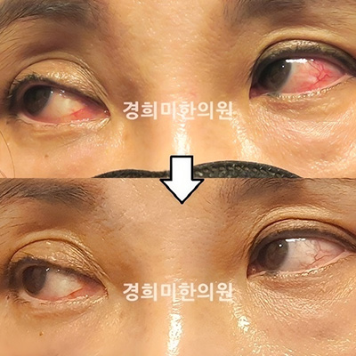 전후사진 이미지3