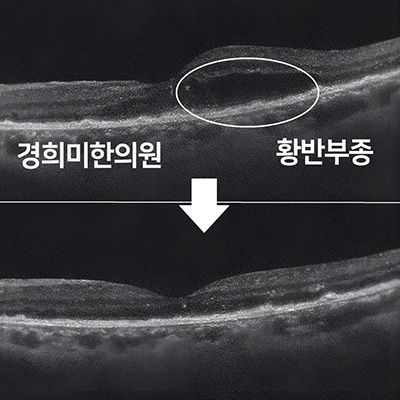 전후사진 이미지2