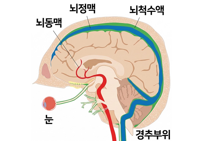 원인 이미지6