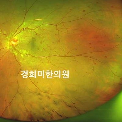 전후사진 이미지1
