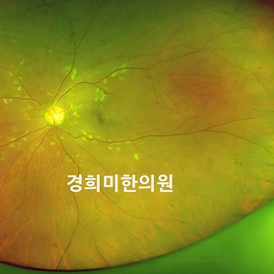 전후사진 이미지2