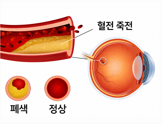 정의 이미지1