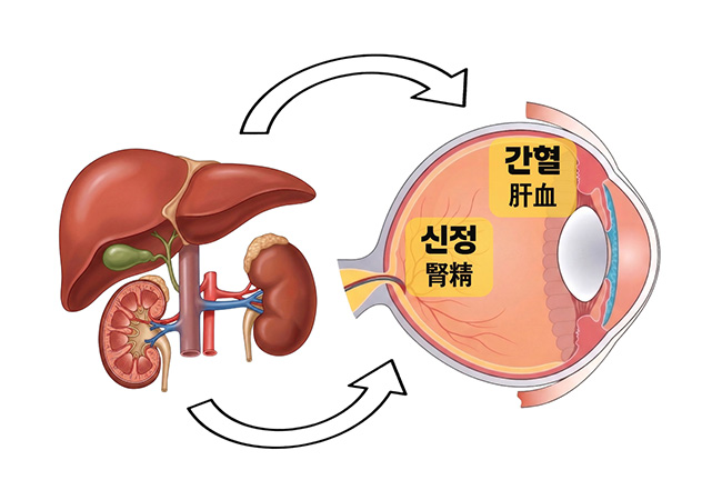 원인 이미지5