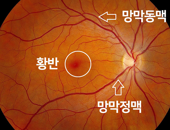 정의 이미지1