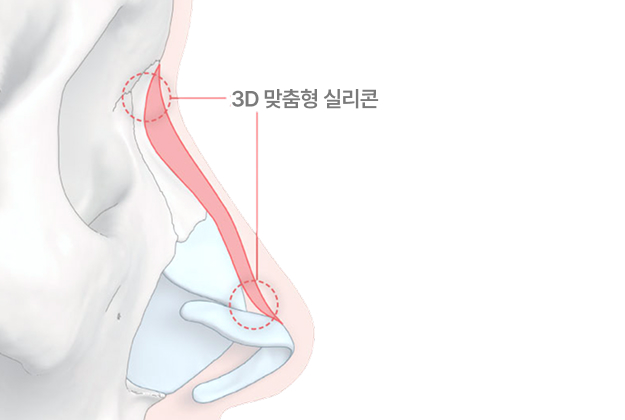 포인트 3