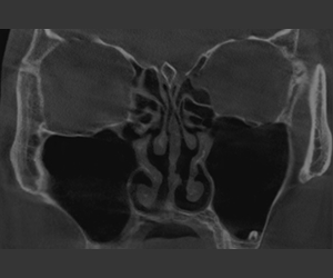 3D CT 구조 확인
