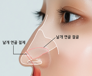처진 코끝 원인 교정