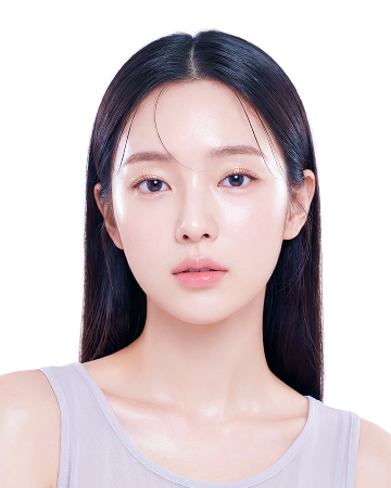 코 재수술 이미지