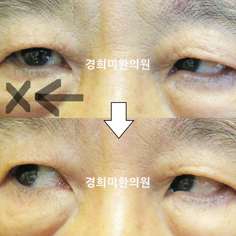 1번-7009-강강-표시.jpg