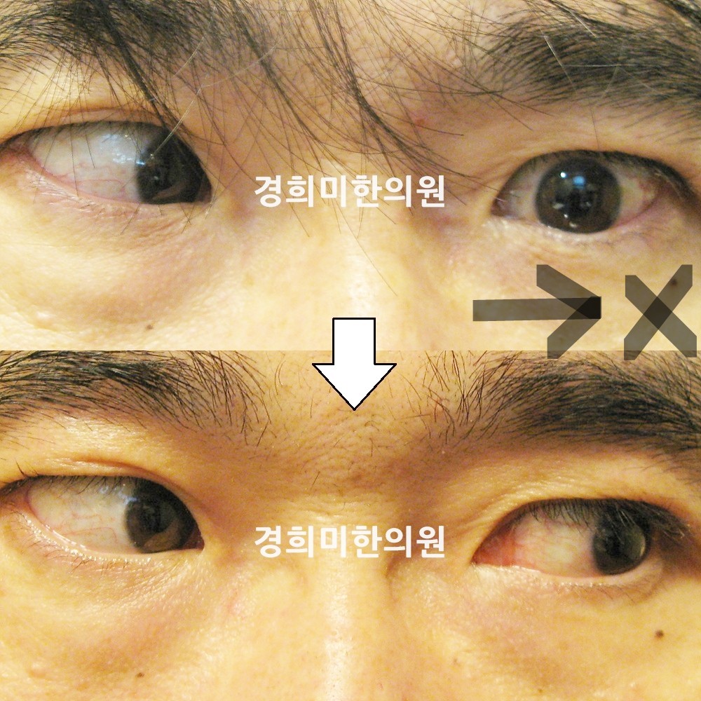 3번-10399-강강-표시.jpg