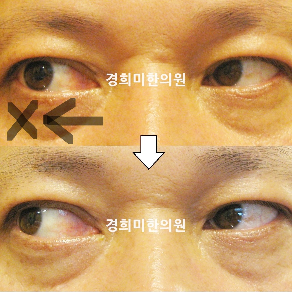 5번-11604-강강-표시.jpg