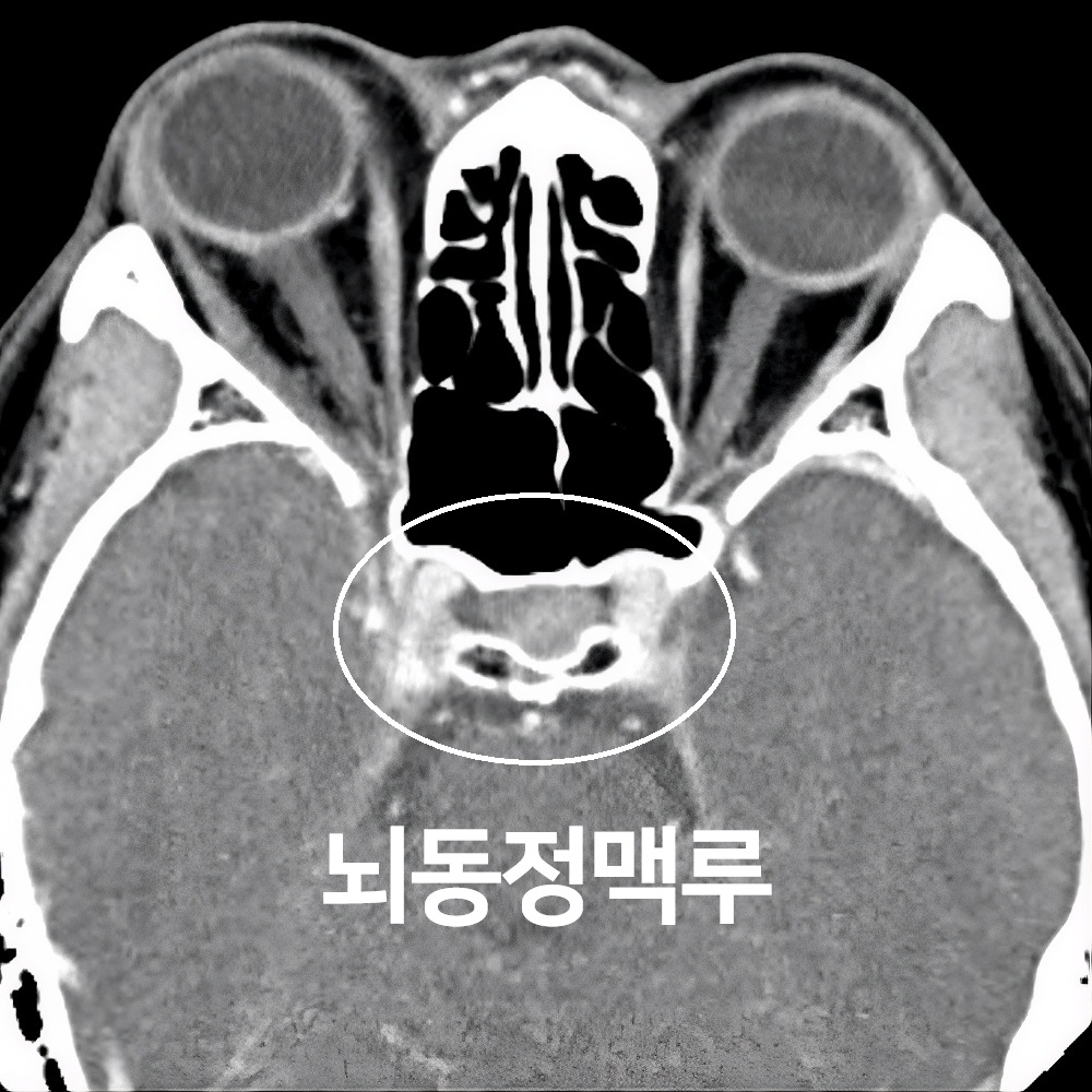 5번-11604-CT3.jpg