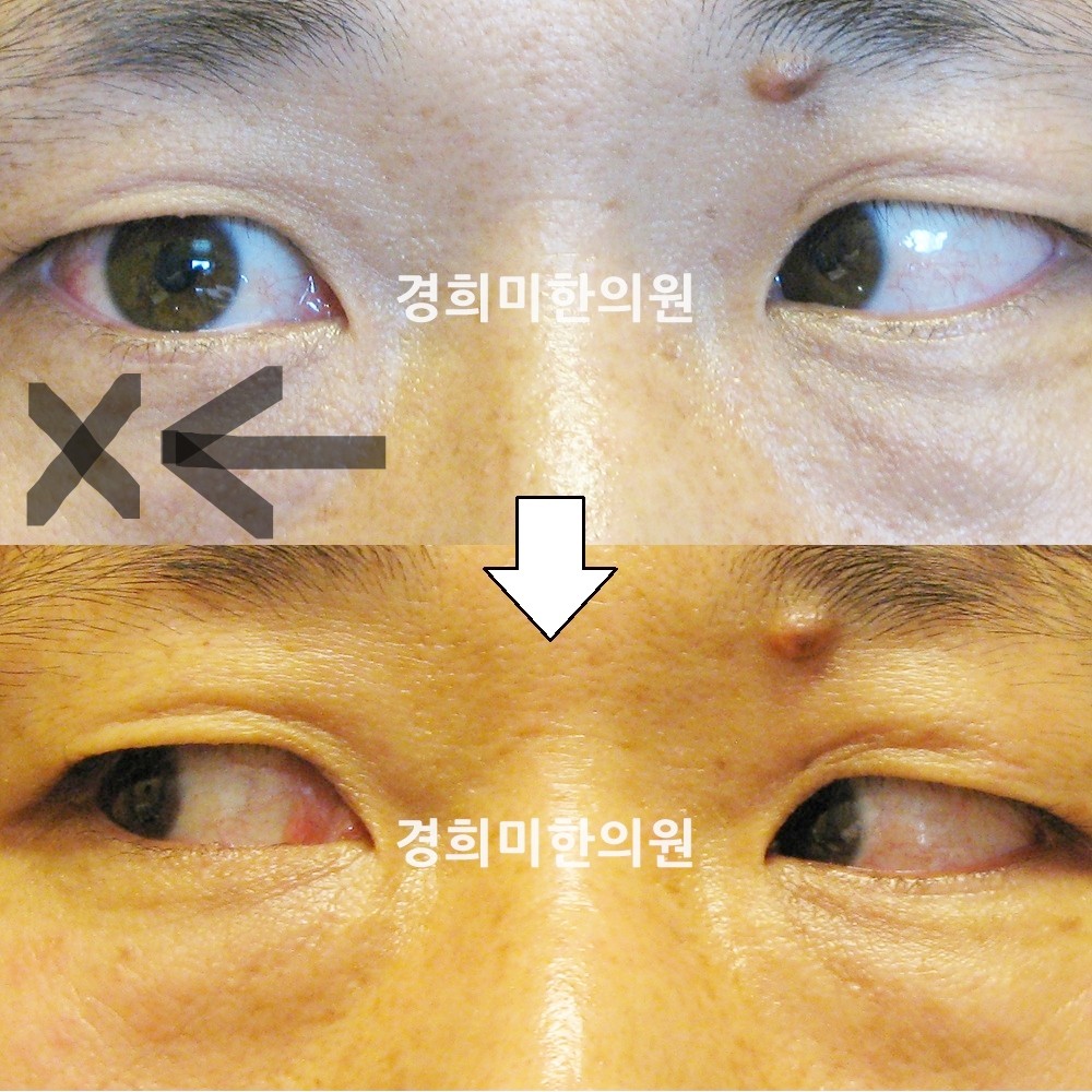 7번-11684-강중-표시.jpg