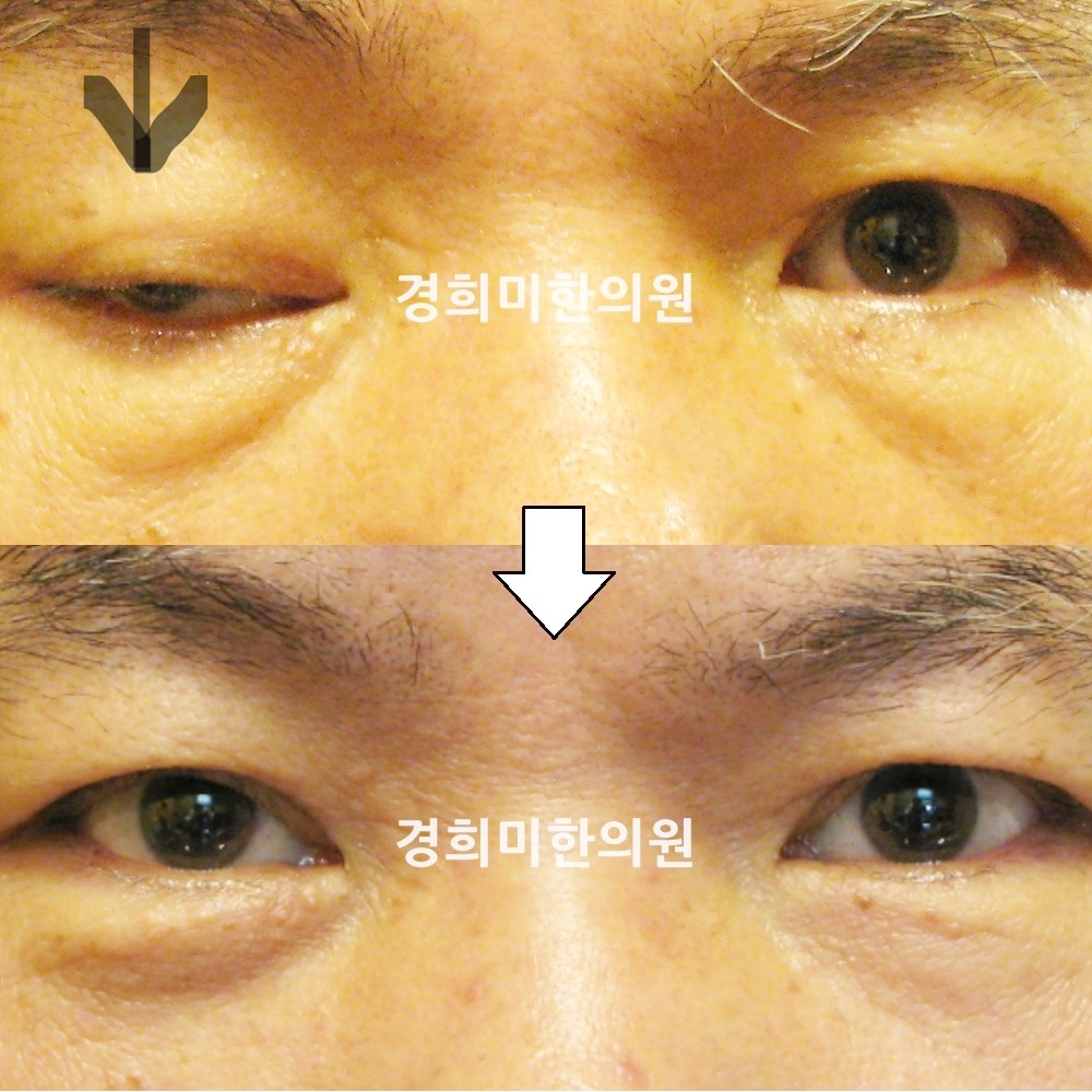 9번-11972-강중-표시.jpg