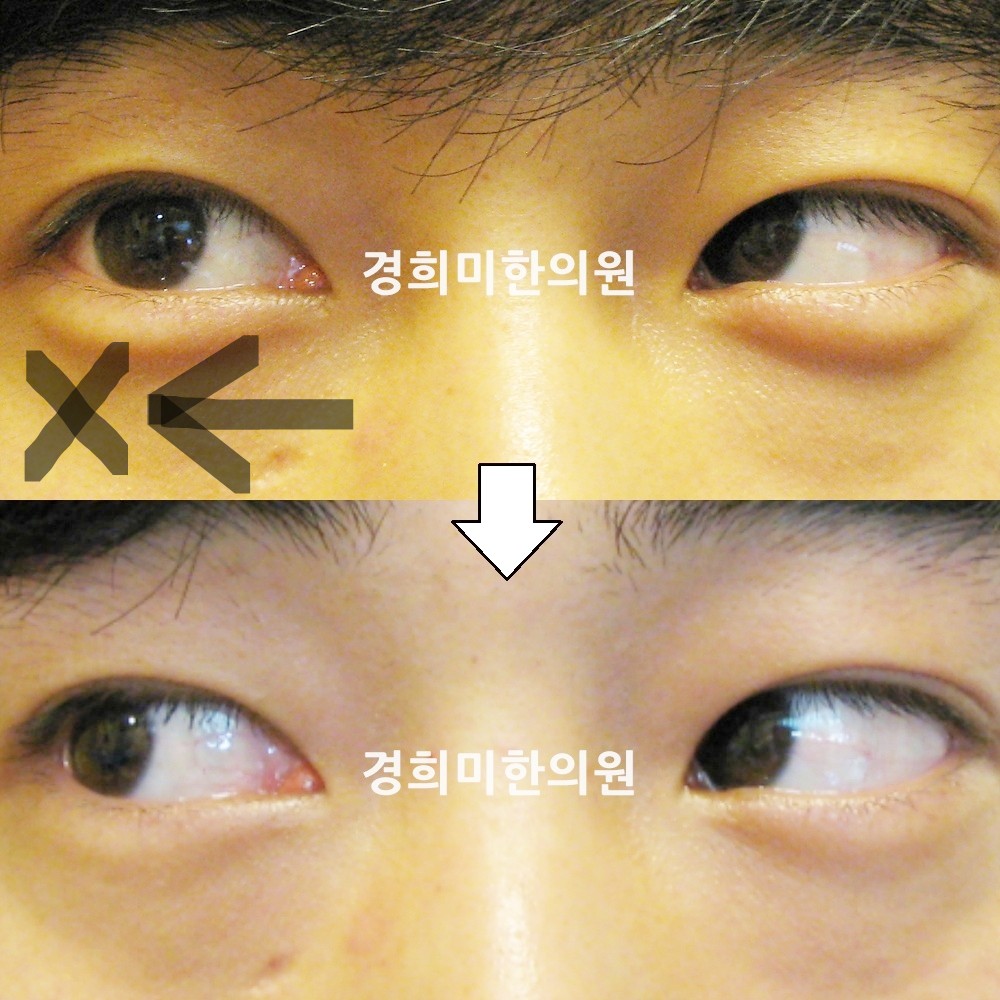 10번-12141-강강-표시.jpg
