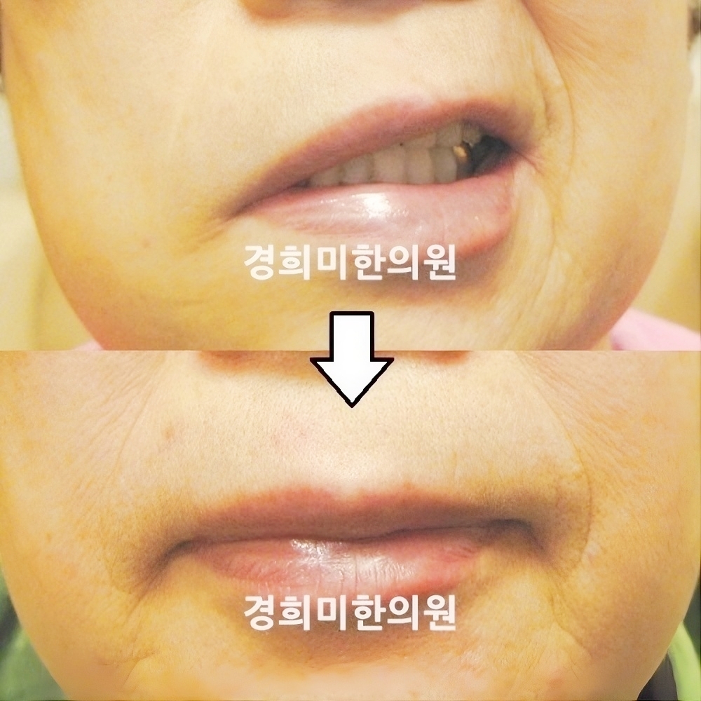 1번-2101.jpg