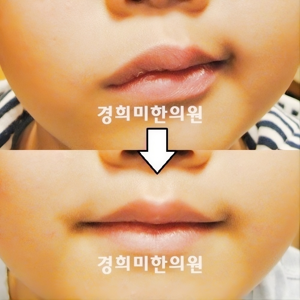 4번-11268.jpg