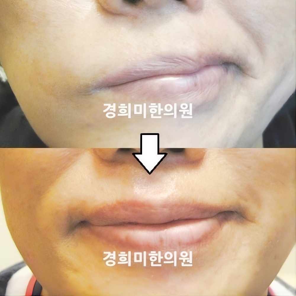 6번-10833.jpg