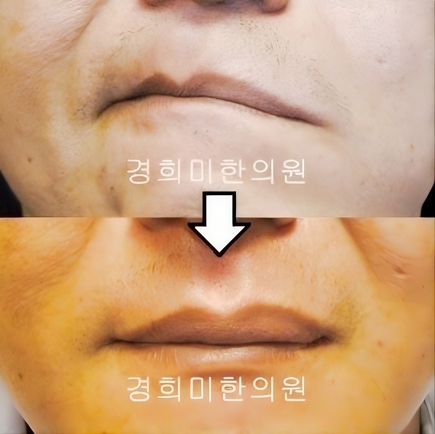 8번-13047(3차발병).jpg
