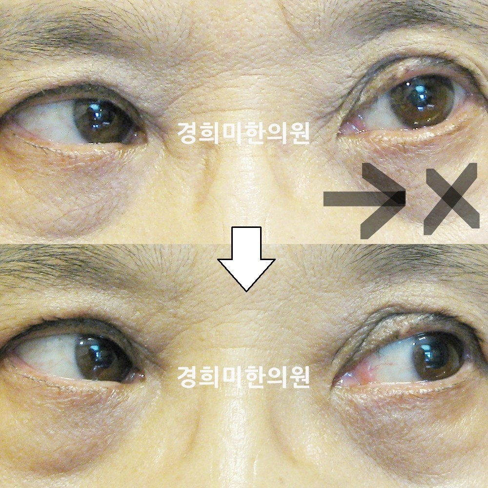 11번-12230-강강-표시.jpg