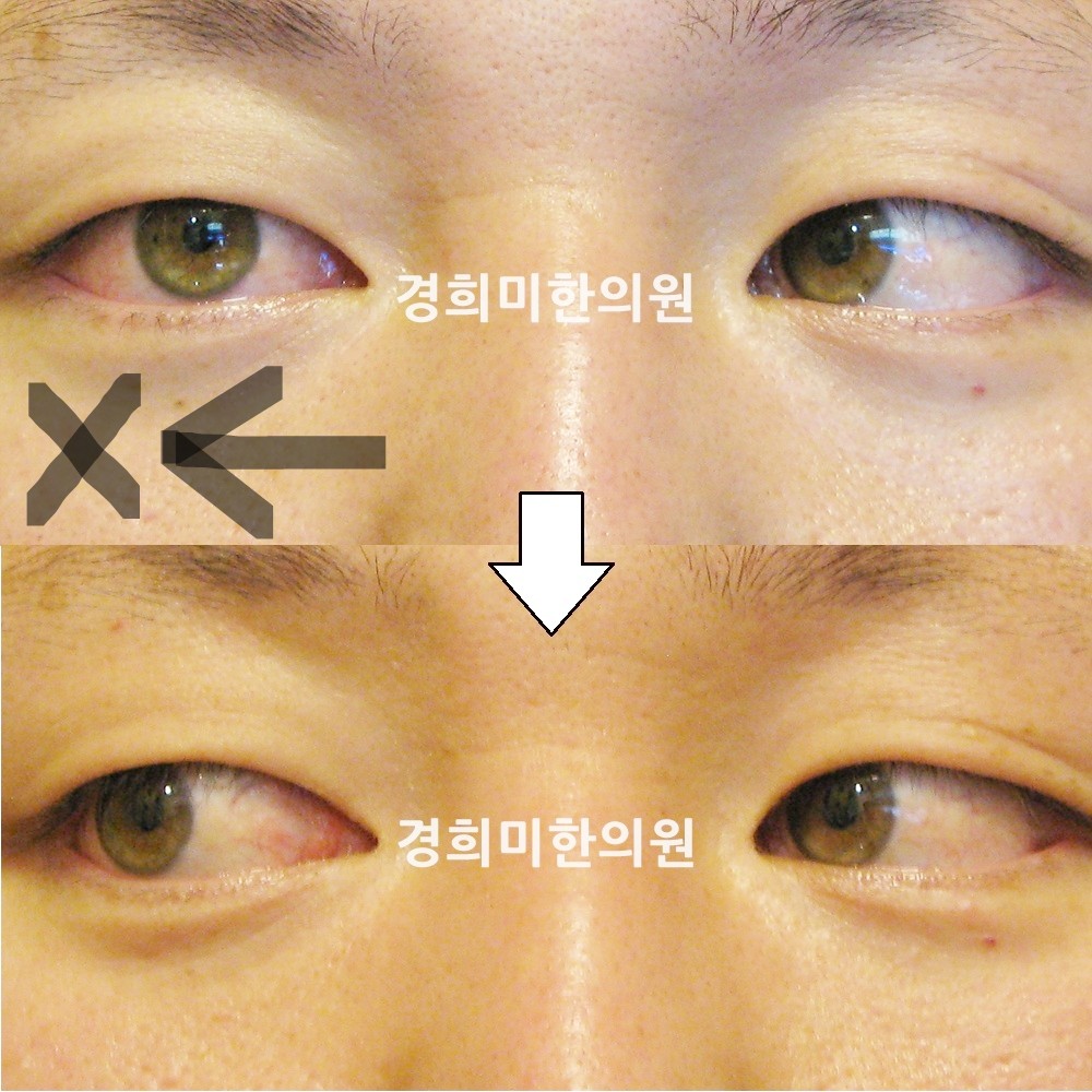19번-12650-강중-표시.jpg