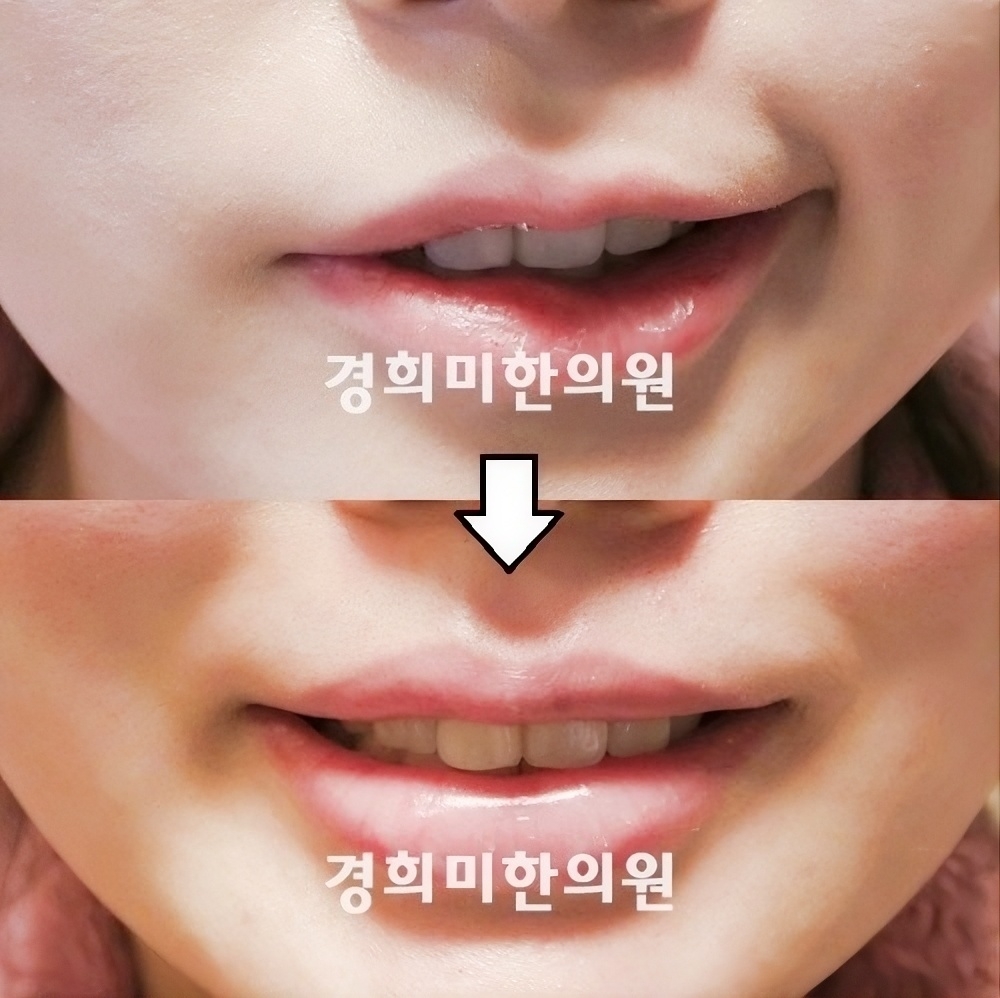 12번-16367(람세이헌트).jpg