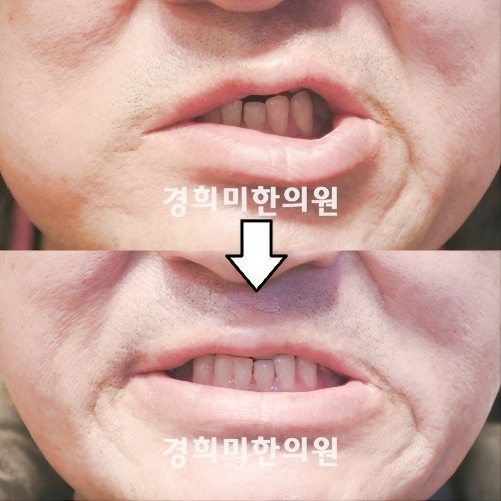 14번-10207.jpg